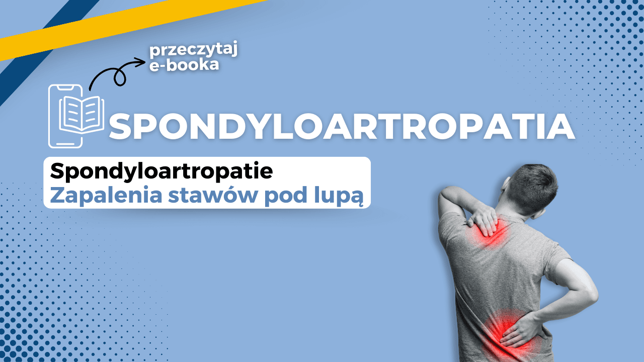 Spondyloartropatia Ebook