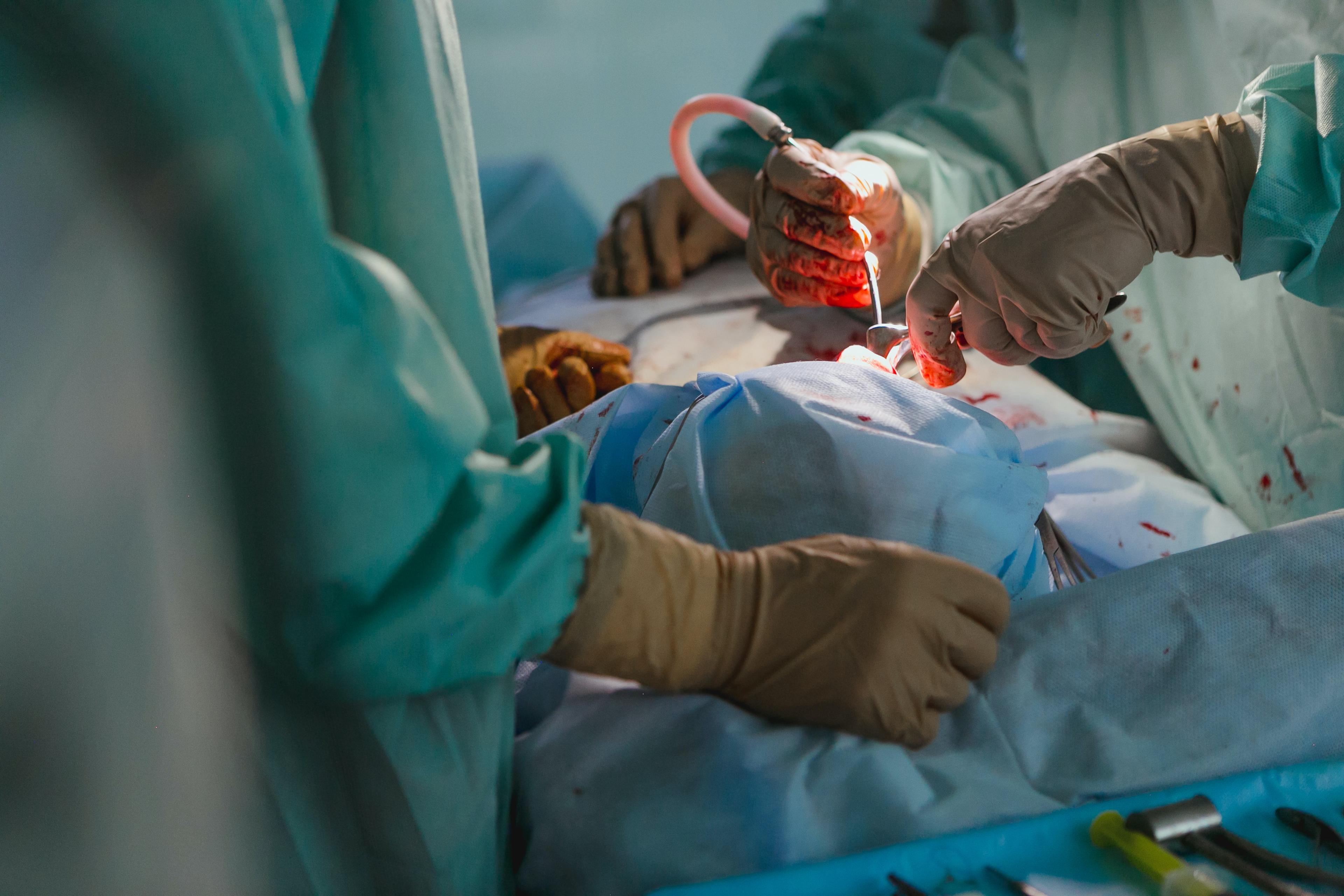 Operacja przeszczepienia wątroby - kto się kwalifikuje i na czym polega operacja? Przeszczep wątroby - metoda leczenia raka