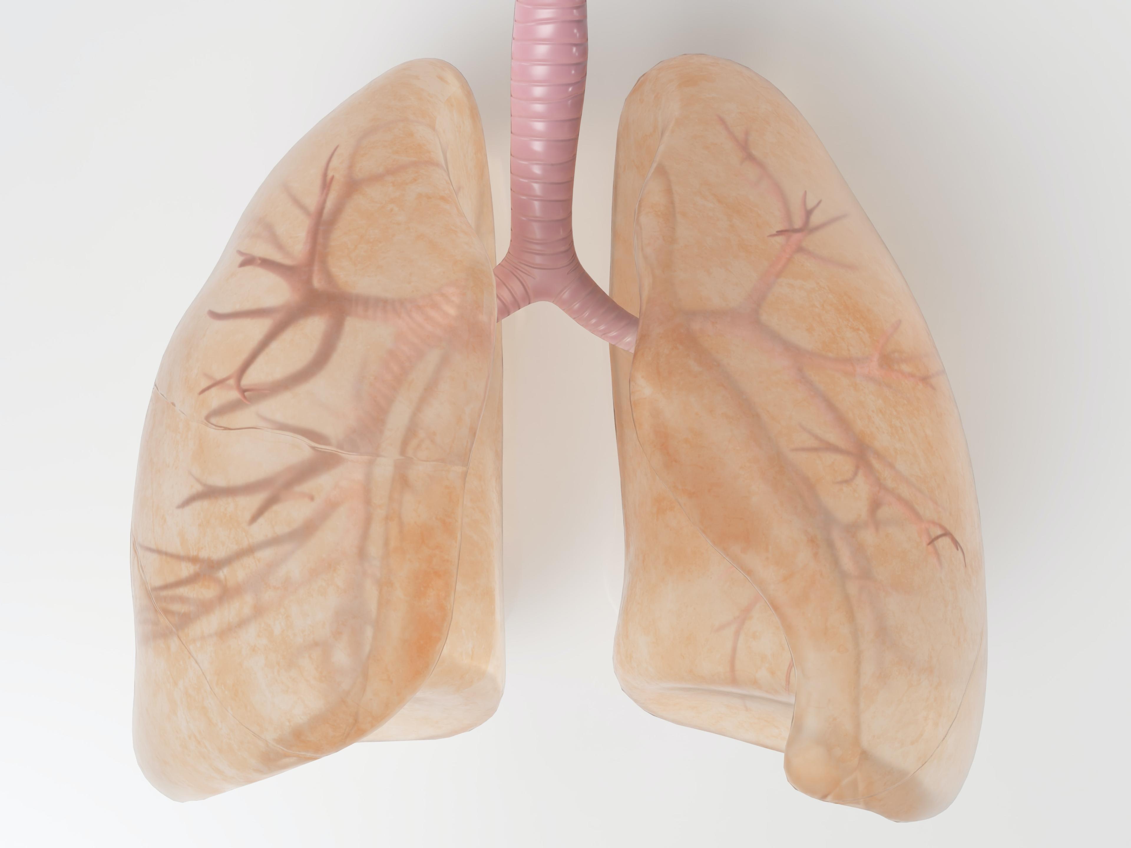Przeszczep płuc - jakie są wskazania, jak przebiega zabieg i życie po przeszczepie płuc 