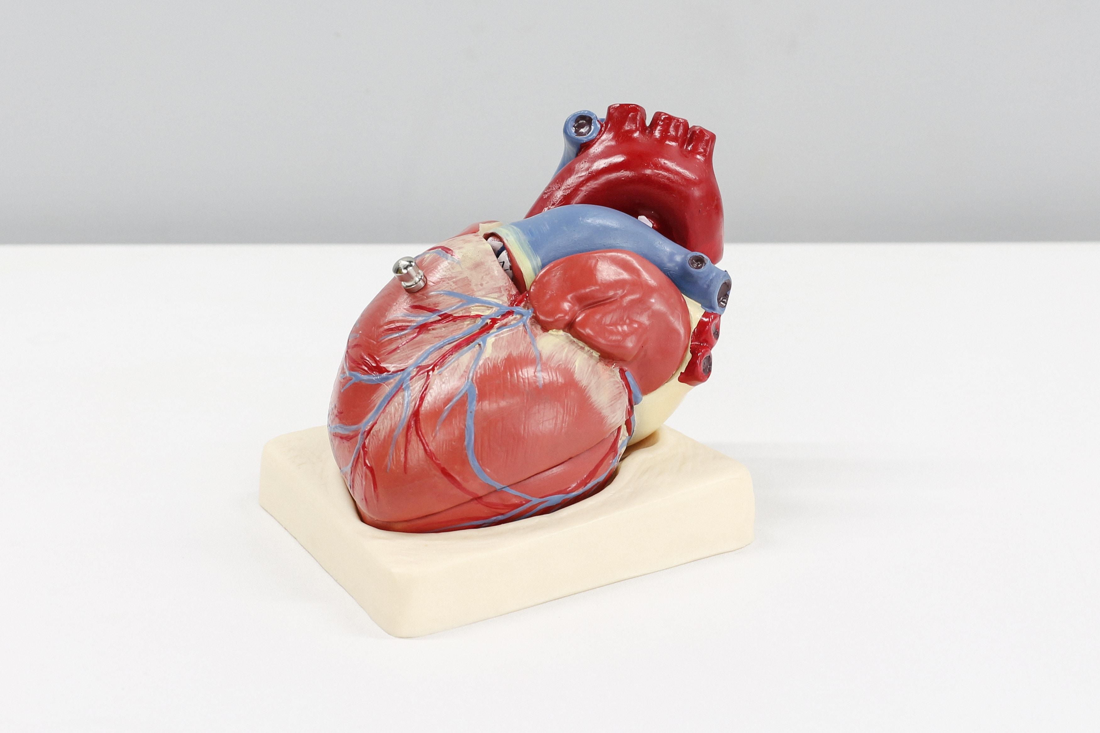 Jak działają stenty i jak wygląda życie po ich wszczepieniu? Stenty w sercu – jak zapobiec restenozie? Rokowanie chorego po zabiegu stentowania tętnicy 