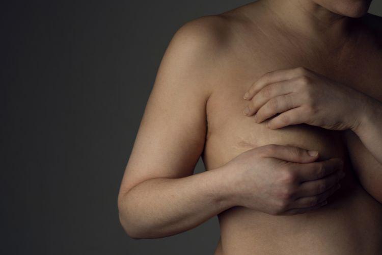 Mastektomia - rodzaje, wskazania, przebieg i ryzyko. Jakie są rodzaje mastektomii piersi? Czym jest mastektomia prosta i profilaktyczna mastektomia?