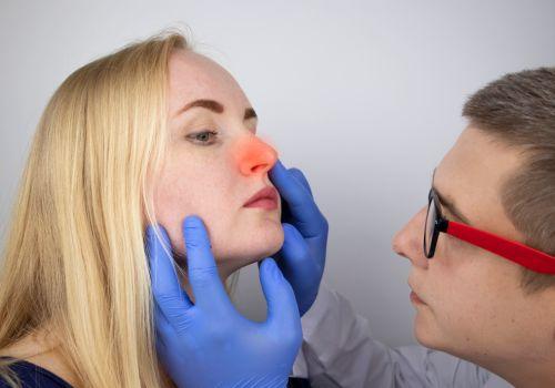 Polipy w nosie - skąd się biorą i jak je leczyć? Polipy w nosie - objawy, leczenie, usuwanie. Domowe sposoby na polipy w nosie 