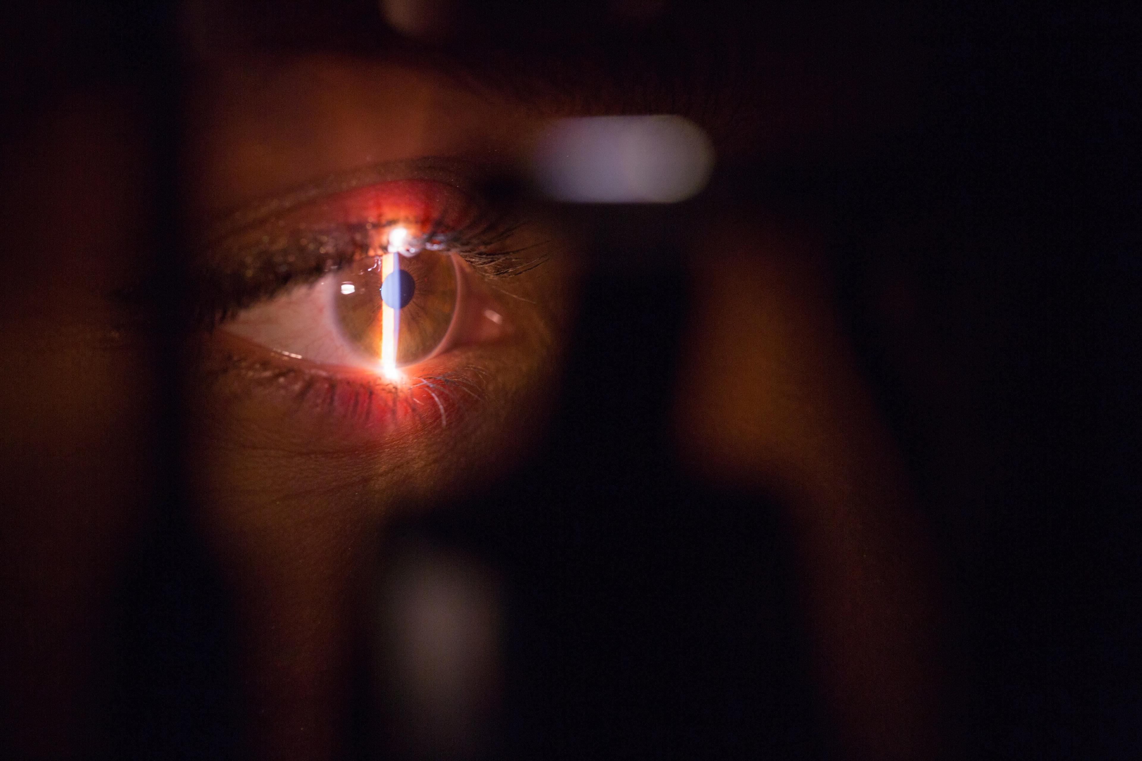 Laserowa korekcja astygmatyzmu - co trzeba wiedzieć? Laserowa korekcja wzroku – jak przygotować się do zabiegu? Wszystko, co musisz wiedzieć o laserowej korekcji wzroku 