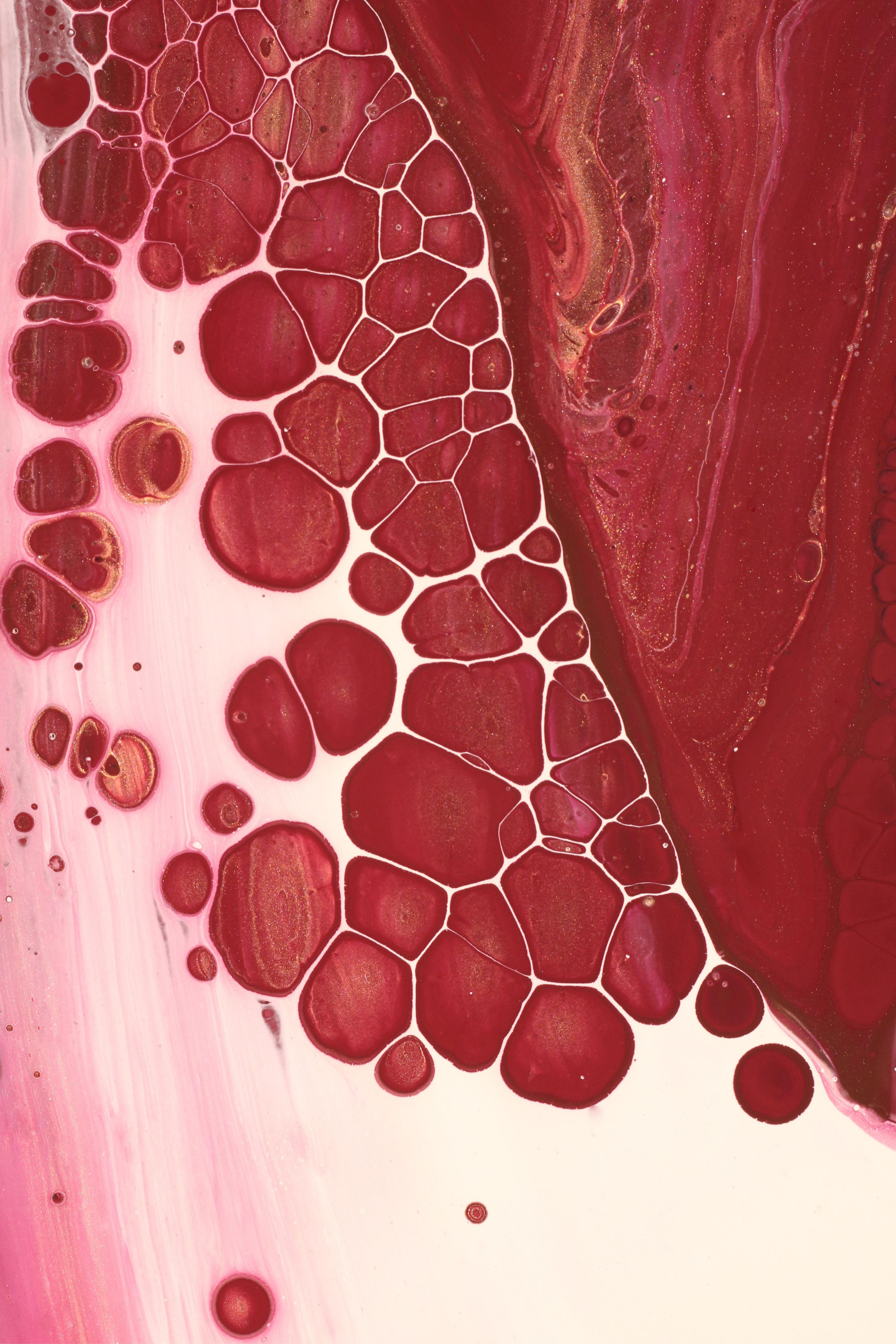 Angioplastyka wieńcowa – na czym polega i kiedy się ją wykonuje