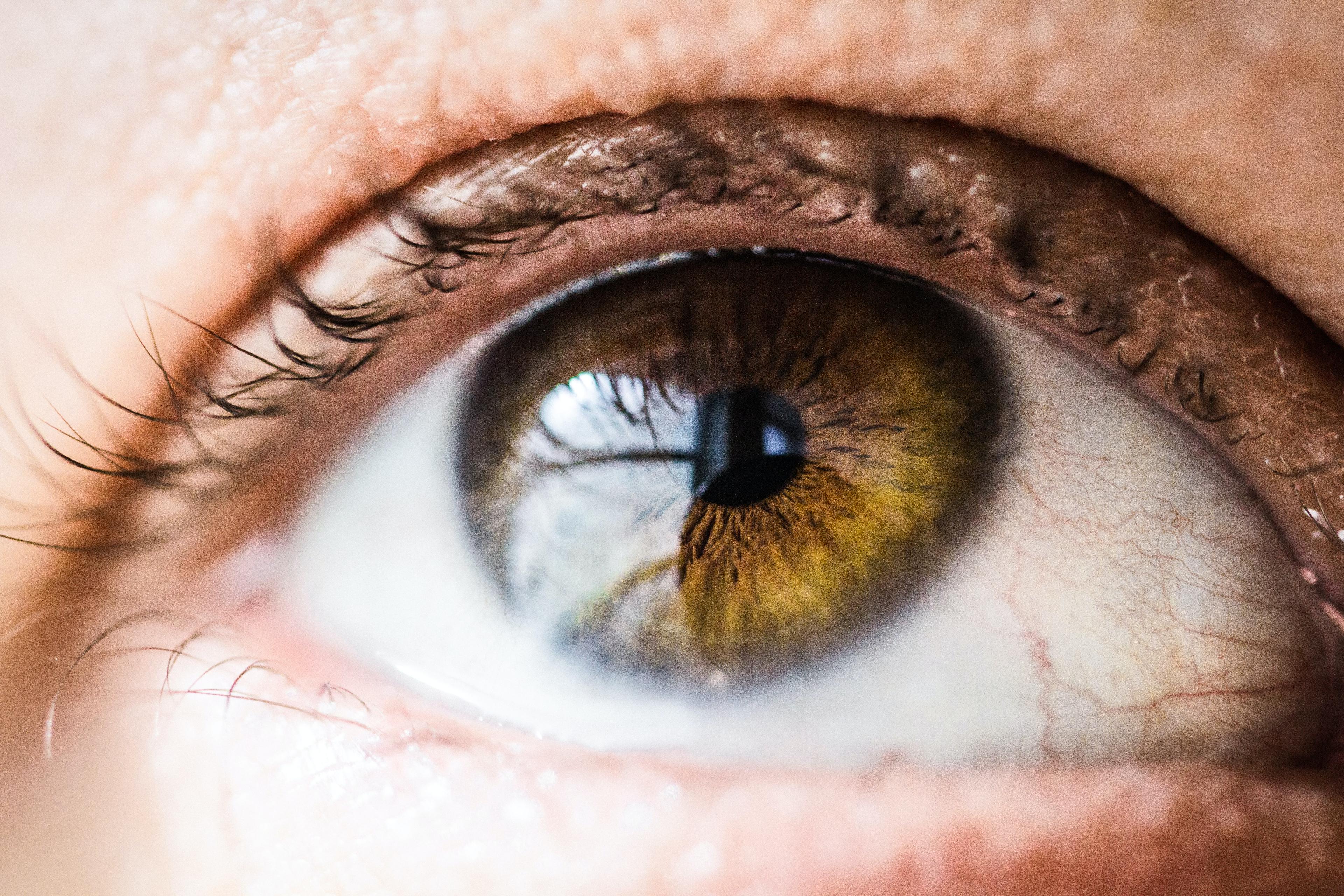 Zespół suchego oka: Przyczyny, objawy i łagodzenie dyskomfortu. Objawy i leczenie zespołu suchego oka – czym jest i jak go leczyć. Metody leczenia 