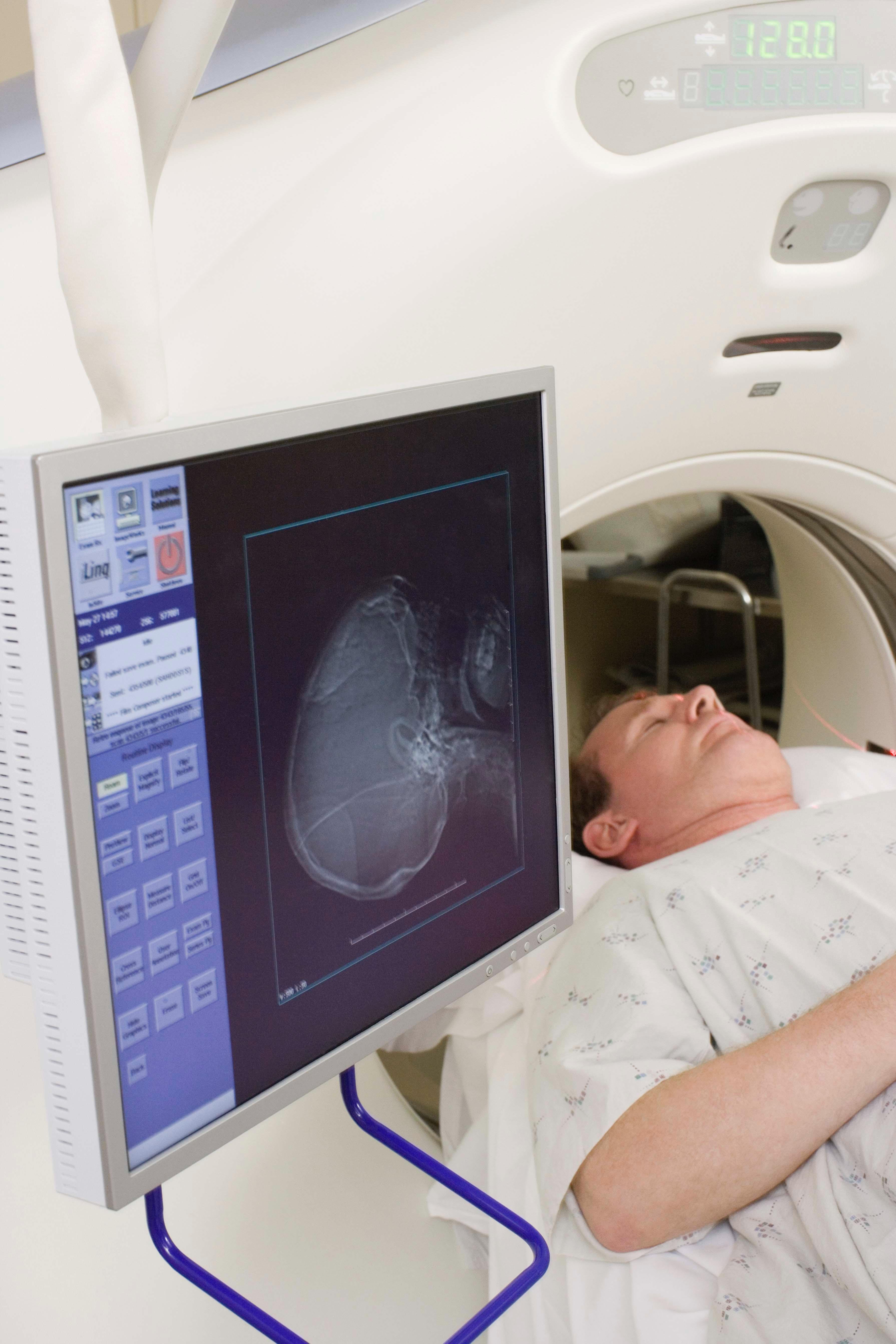 Rezonans magnetyczny (MRI) głowy – jak wygląda i jak się przygotować