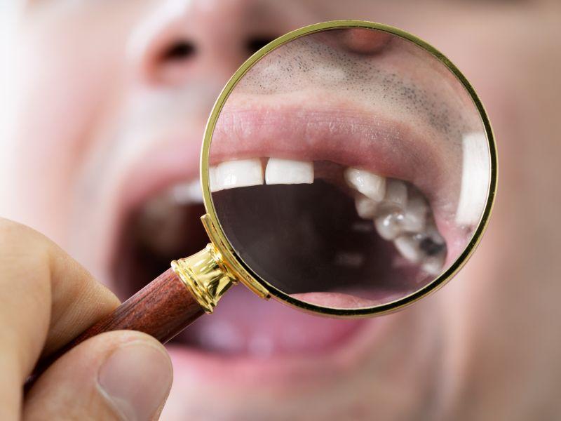 Braki zębów to dziś żaden problem