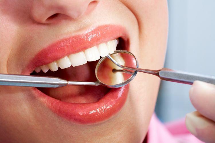 Higienizacja zębów - co to jest i po co się ją wykonuje? 