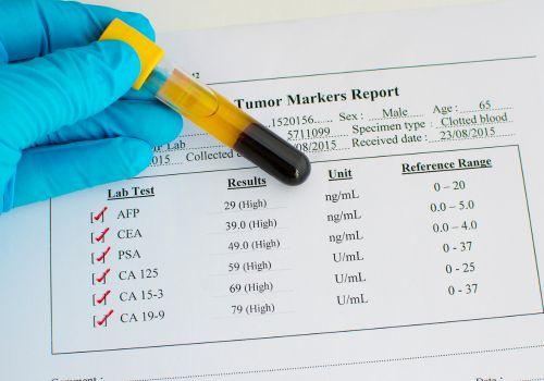 Markery nowotworowe – rodzaje i skuteczność