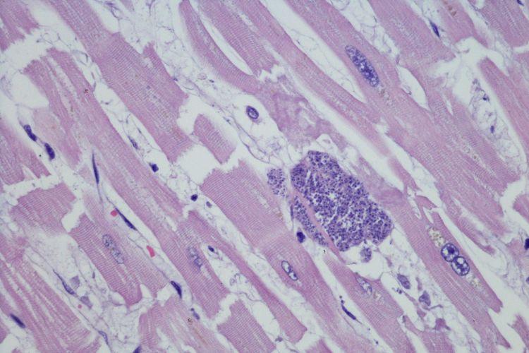Toksoplazmoza – drogi zakażenia, objawy i ciąża