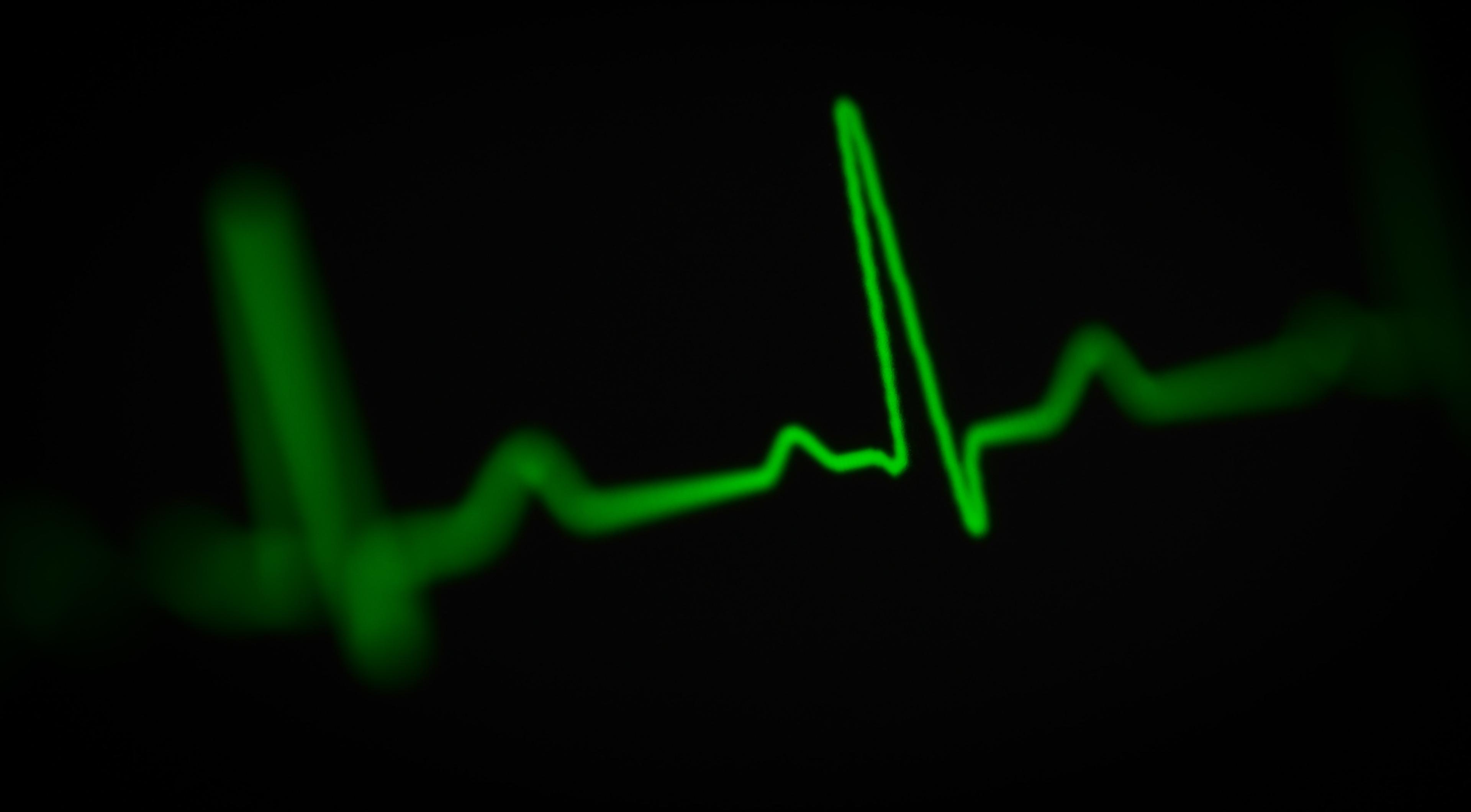Elektrokardiografia (EKG): jak wygląda badanie? Na czym polega badanie ekg? Jak wygląda przebieg badania serca?