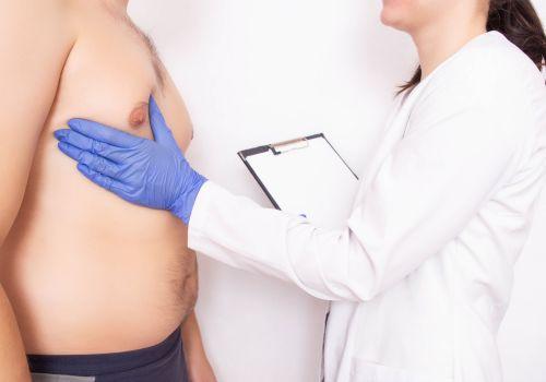 Ginekomastia – objawy i leczenie przerostu gruczołu piersiowego u mężczyzn