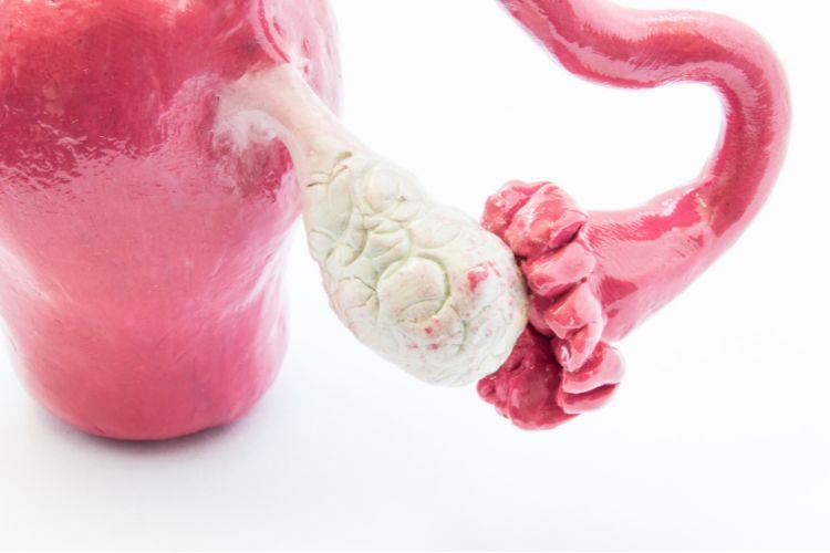 Tyłozgięcie macicy – jak wpływa na zdrowie i czym różni się od przodozgięcia?