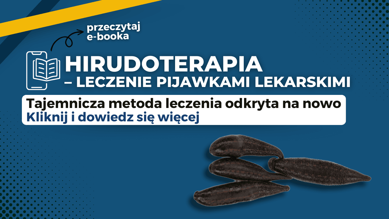 Hirudoterapia - leczenie pijawkami lekarskimi