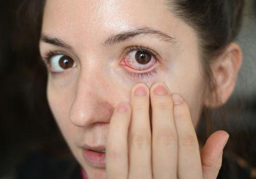 Jakie stosować zioła dla zdrowia oczu? Zioła a stany zapalne oczu