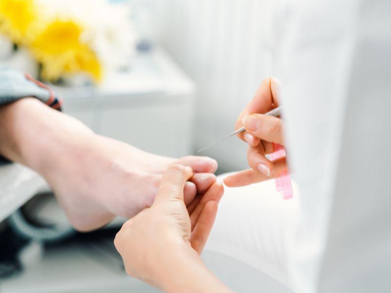 Wizyta u podologa nie powinna być wstydem. Czasem to konieczność!