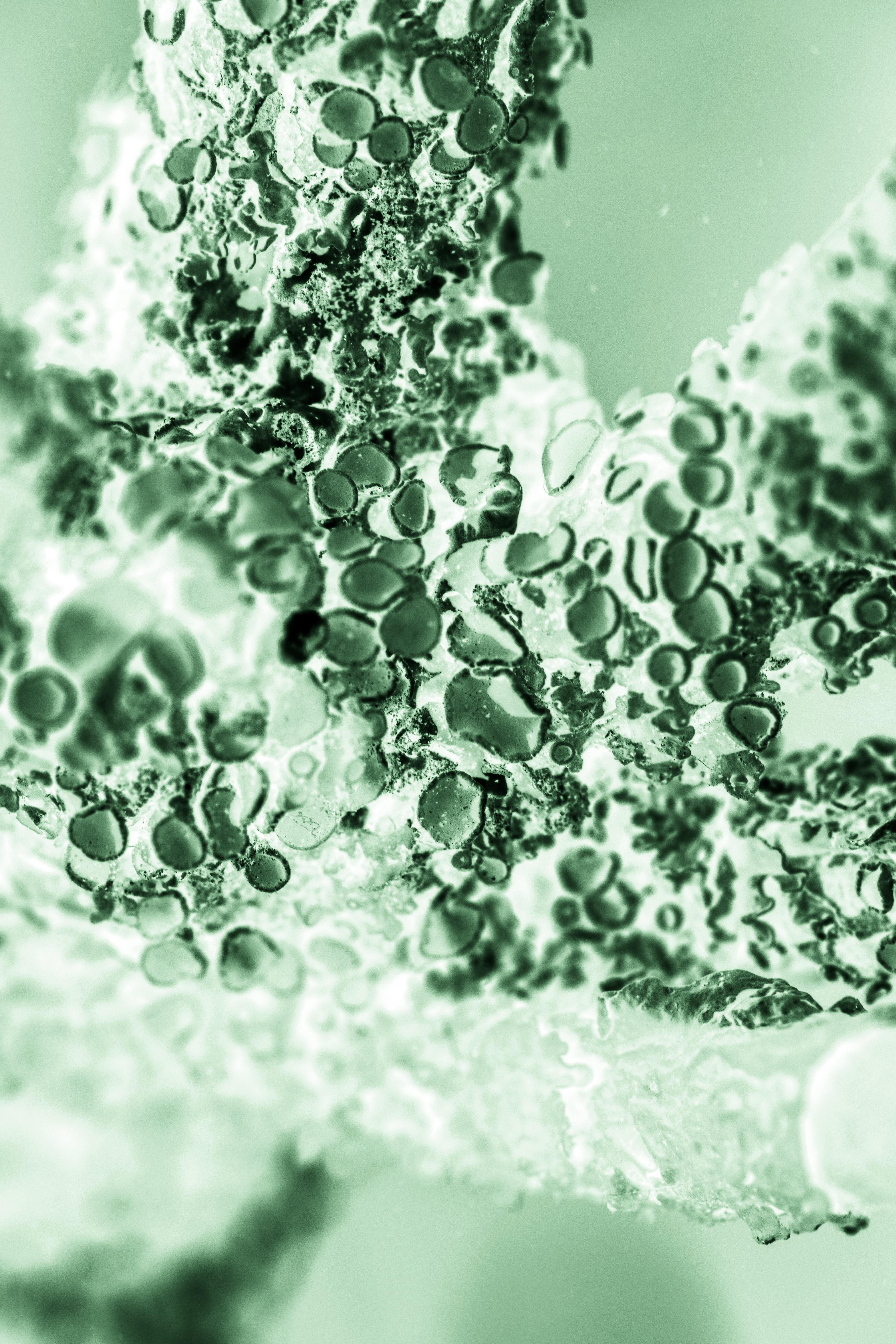 Treonina – właściwości i zastosowanie