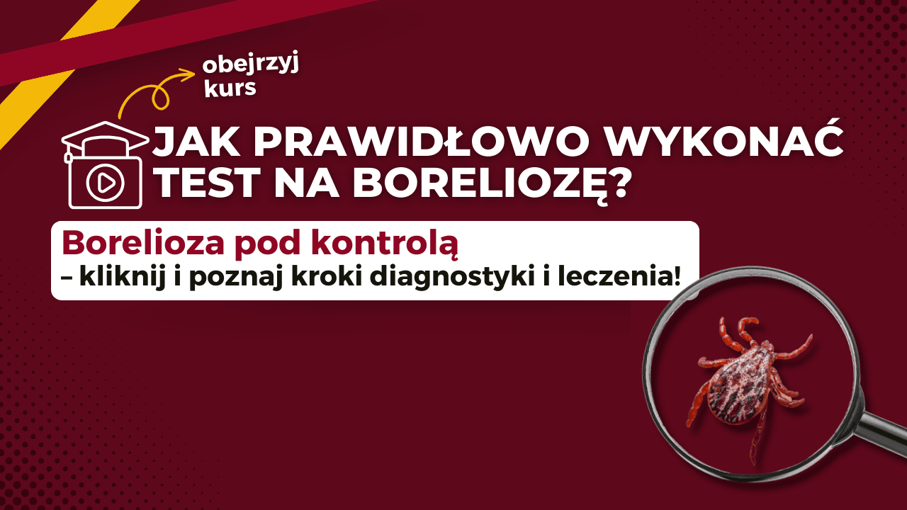 Jak prawidłowo wykonać test na boreliozę i dobrać odpowiednią kurację
