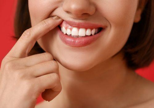 6 sposobów na zdrowe dziąsła. Bóle dziąseł – domowe sposoby