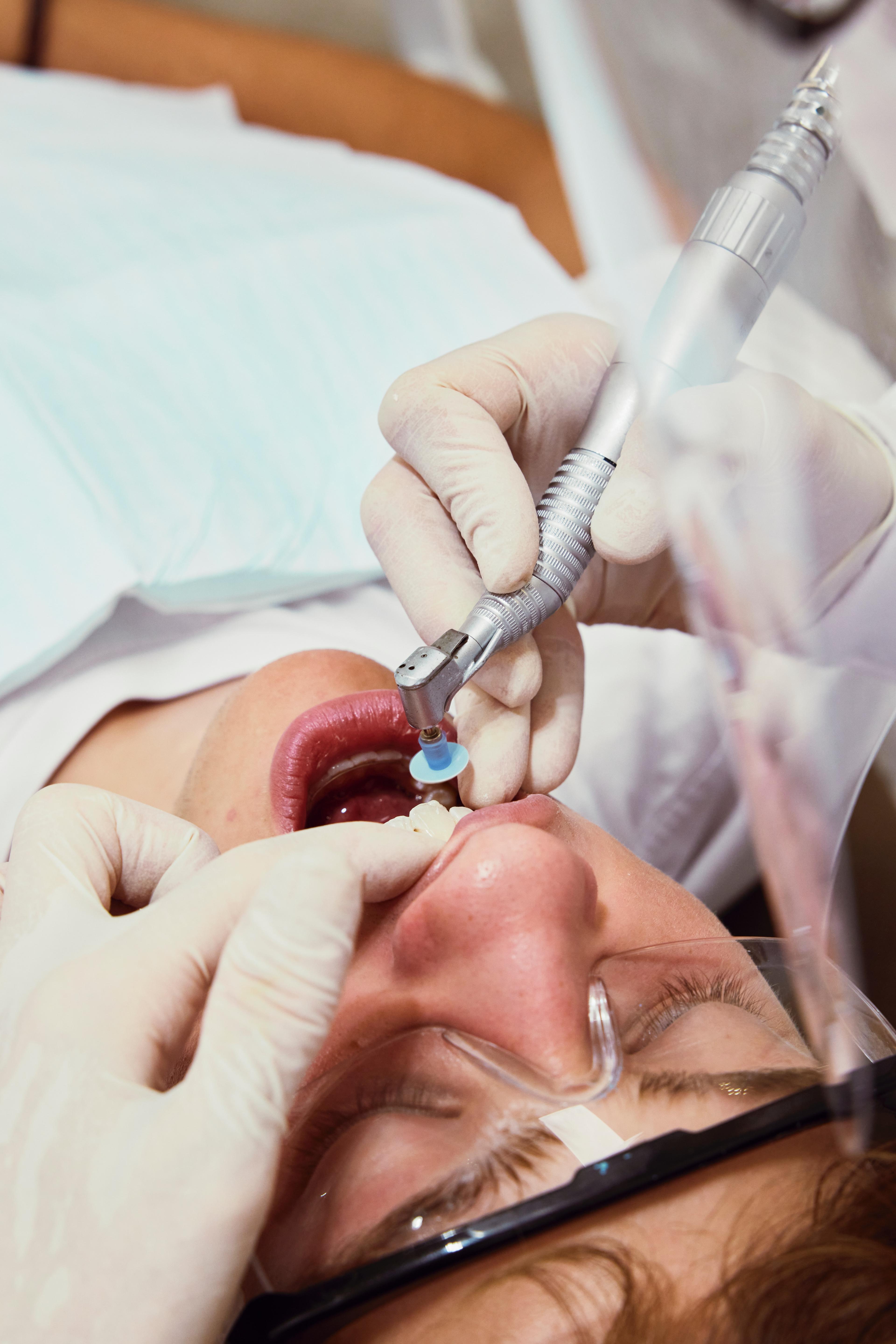 Przebarwienia na zębach – rodzaje, przyczyny i skuteczne usuwanie