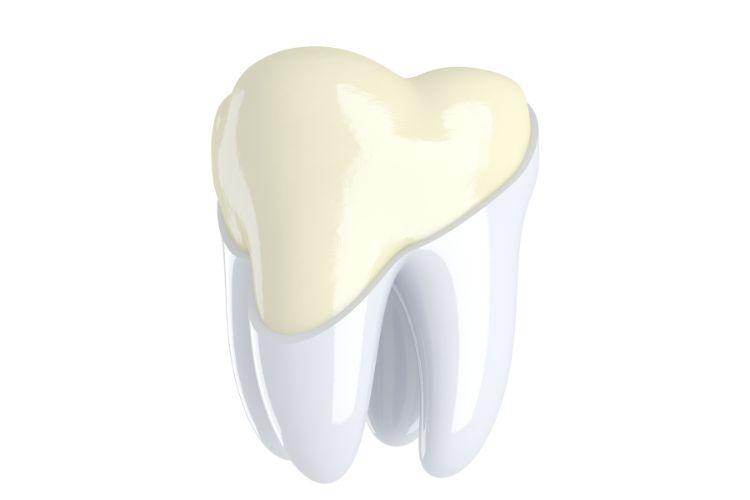 Rysy na szkliwie i białe plamy na zębach – skąd się biorą i jak je leczyć?